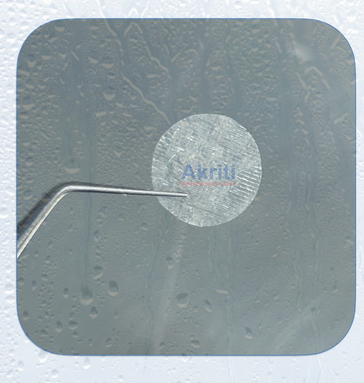 Amnio-Disc 10.00 mm (Dehydrated Amniotic Membrane)